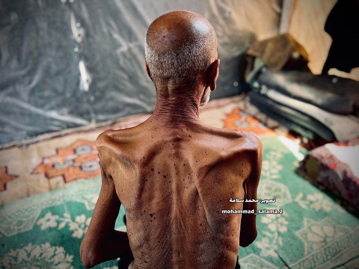 HalaJaber's tweet photo. These images are a gut-punch in pixels. Salim Asfour, 85, skeletal, still surviving what no human should have to endure once, let alone repeatedly. From the Nakba to now, he’s witnessed every promise of “never again” twisted into again & again.

What kind of world lets a man survive catastrophe after catastrophe only to be starved in the final chapter of his life? They call this war, but it not. This  is cruelty on a loop & the clock is running out.

There is no strategic justification for letting people wither like this. Only moral failure. Monumental, willful, & historic.