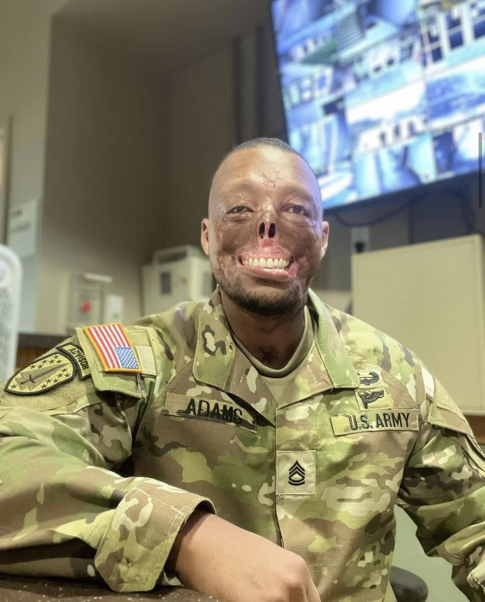 “And I'm still going to wear it with pride until my last day. Army Strong!”

-Randy Adams