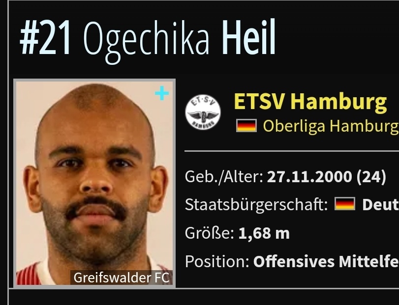 What happened to bro's hairline 😭💔