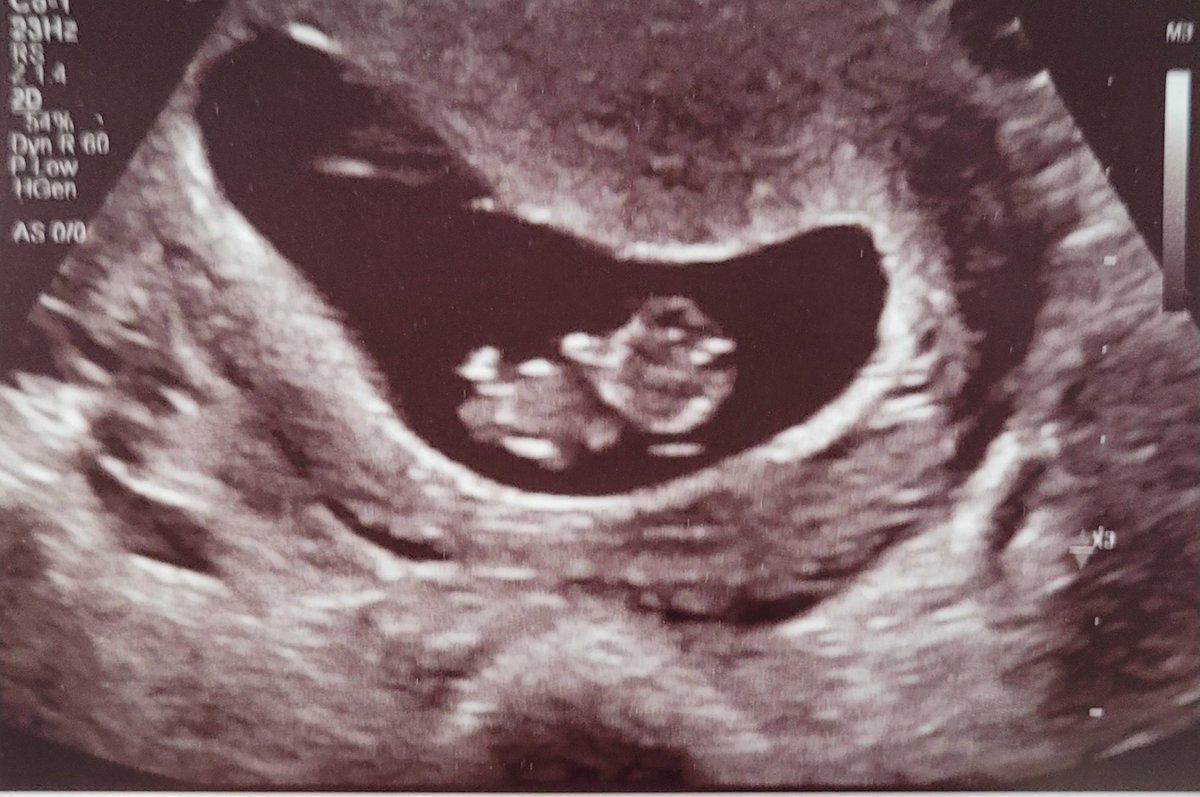 Blake Bent tweet media