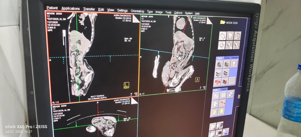 TheDogMother_'s tweet image. Battling most critical of cases with back to back #rescue calls! Im overwhelmed with bills, credit &amp;amp; shortage of #food. Urging you all to #doyourbit 🙏
UPi 8810309001@kotak or via our Amazon Wishlist amazon.in/hz/wishlist/ls…
Every bit matters 🐾🐾
#Dogs #RescueDogs #Kindness