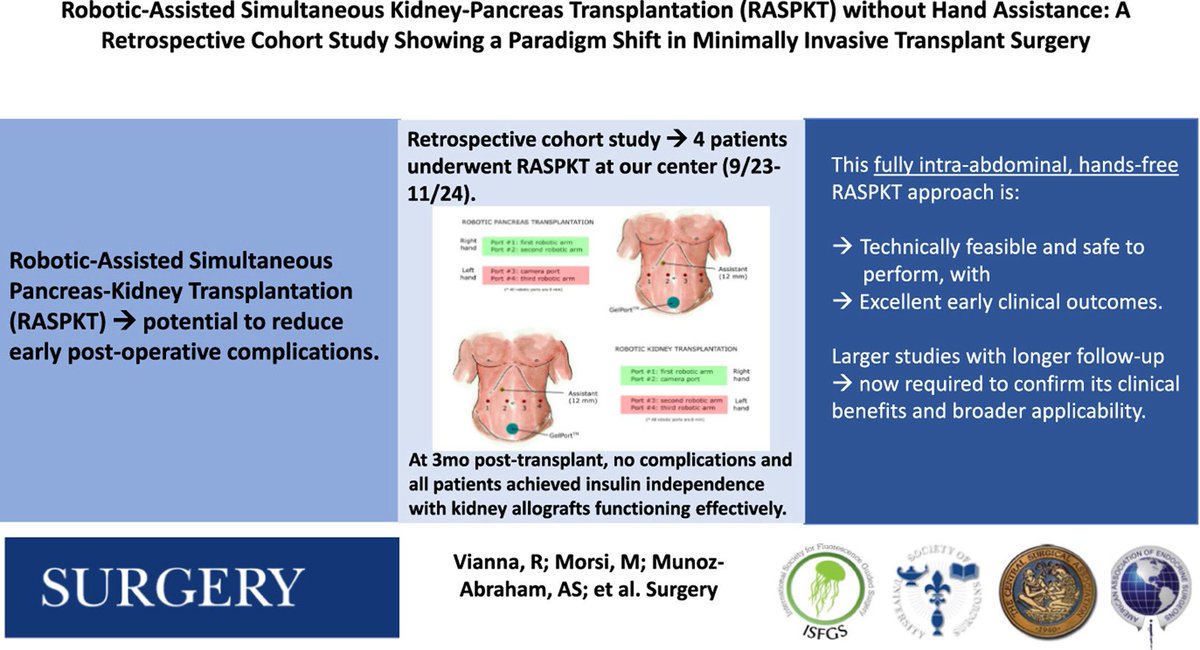 Steven D Wexner MD, PhD (@swexner) on Twitter photo Robotic-assisted simultaneous kidney-pancreas transplantation (RASPKT) without hand assistance: A retrospective cohort study showing a paradigm shift in minimally invasive transplant surgery surgjournal.com/article/S0039-… great <a href="/SurgJournal/">SURGERY Journal</a> OPEN ACCESS study Robotic-assisted simultaneous kidney-pancreas transplantation (RASPKT) without hand assistance: A retrospective cohort study showing a paradigm shift in minimally invasive transplant surgery surgjournal.com/article/S0039-… great <a href="/SurgJournal/">SURGERY Journal</a> OPEN ACCESS study