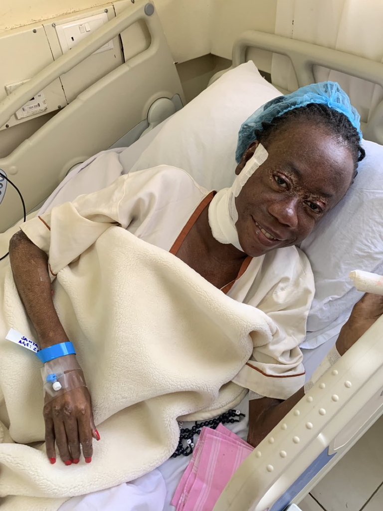 Gideon Nova Kwikiriza (@kwikirizanova) on Twitter photo Hallo guys, letโs do what we do best. Sheโs one of us. <a href="/Bossbaeomubwati/">Saantah๐..With the scars๐๐</a> was diagnosed with a rare form of Cancer and she is undergoing treatment. For anyone who would love to reachout 0779354326๐๐พ. My you find life ๐ Hallo guys, letโs do what we do best. Sheโs one of us. <a href="/Bossbaeomubwati/">Saantah๐..With the scars๐๐</a> was diagnosed with a rare form of Cancer and she is undergoing treatment. For anyone who would love to reachout 0779354326๐๐พ. My you find life ๐