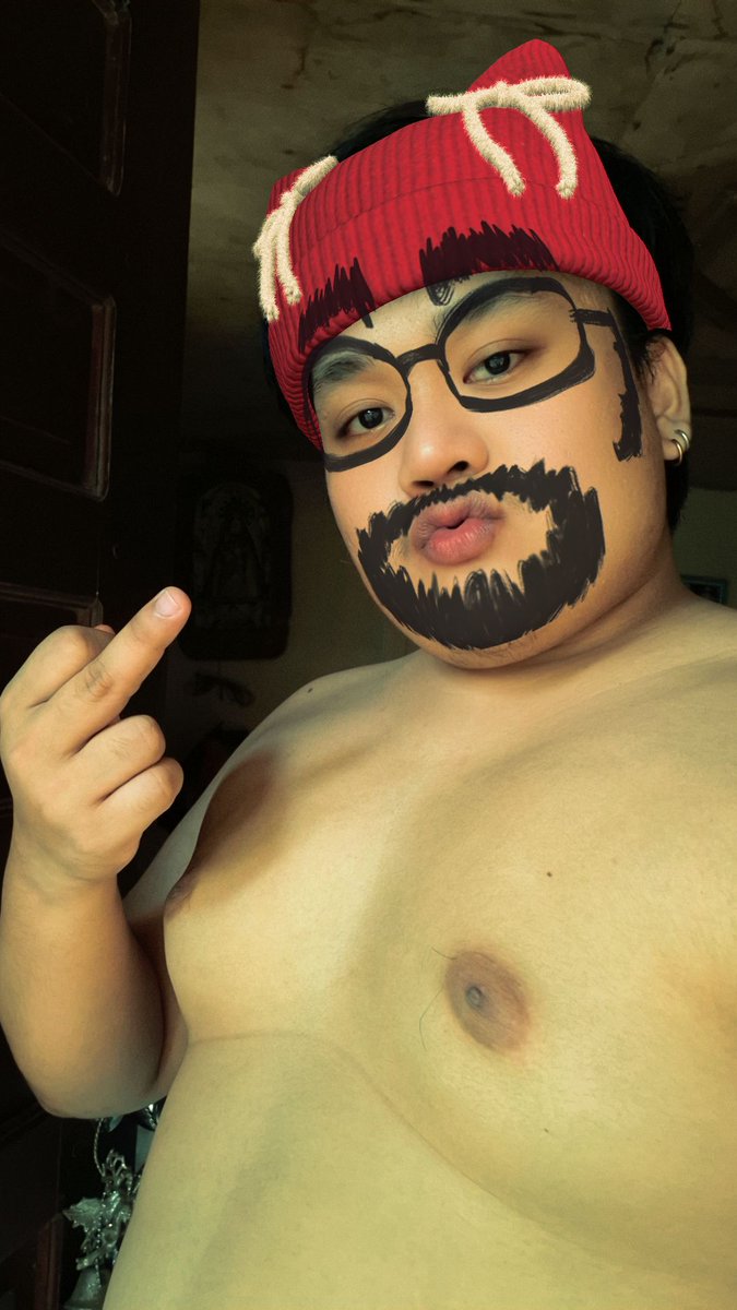 A. Hepa
B. Jaundice 
C. Regine Velasquez