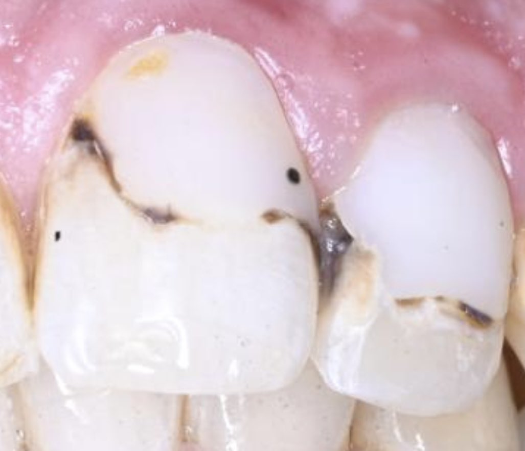 عيسى الرشيدي tweet media