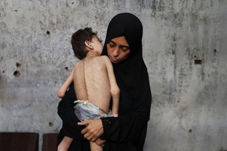Un portavoz regional del Fondo de las Naciones Unidas para la Infancia (UNICEF) informó que, entre el 10 y el 23 de julio, más de 5,000 niños en la Franja de Gaza han padecido desnutrición aguda.