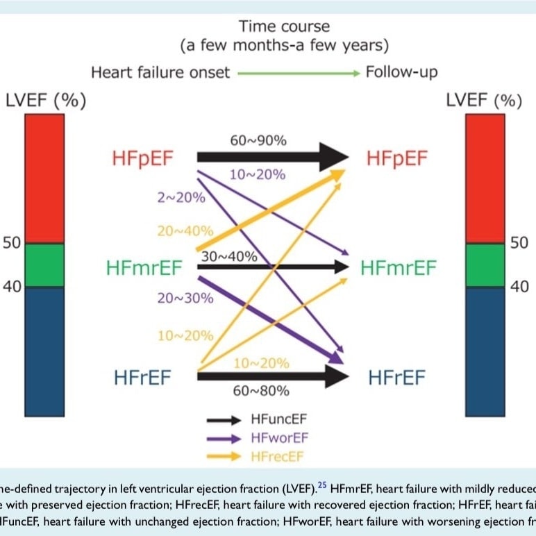 The Heart (@zheart11768530) on Twitter photo 🔴The use of left ventricular ejection fraction in the diagnosis and management of heart failure.⤵️
🔹A 2025 clinical consensus statement of the HFA of the ESC, HFSA & JHFS <a href="/ESC_Journals/">European Society of Cardiology Journals</a>
🔹onlinelibrary.wiley.com/doi/abs/10.100…
#Cardiology #medical #CVD #MedEd #medtwitter #CardioEd 🔴The use of left ventricular ejection fraction in the diagnosis and management of heart failure.⤵️
🔹A 2025 clinical consensus statement of the HFA of the ESC, HFSA & JHFS <a href="/ESC_Journals/">European Society of Cardiology Journals</a>
🔹onlinelibrary.wiley.com/doi/abs/10.100…
#Cardiology #medical #CVD #MedEd #medtwitter #CardioEd