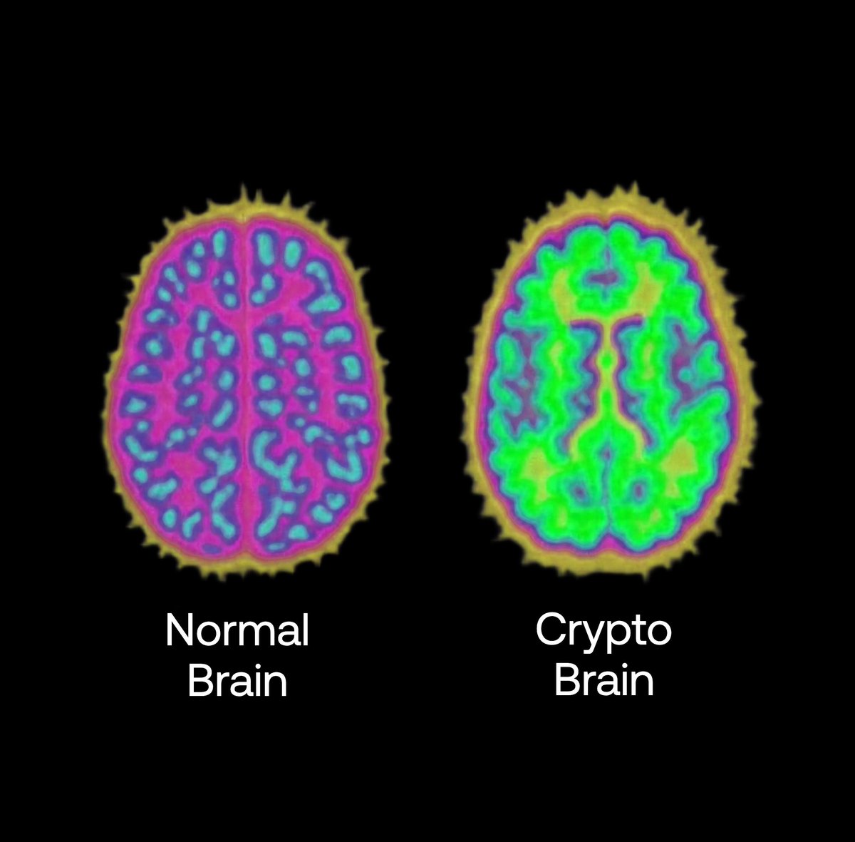 There are two types of brains in this world. How green is yours?