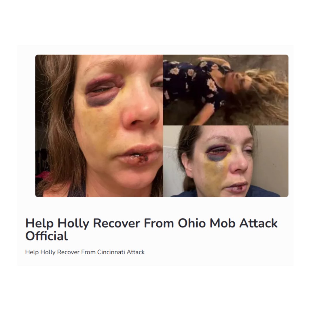 🚨 HOLY CRAP! Holly, the single mom brutalized by the Cincinnati Jazz Festival mob, has now been donated over a QUARTER MILLION dollars ($266,000+).

This is sending a message.

The campaign was at $100K yesterday. It more-than-doubled in one day.

Americans oppose thuggery.