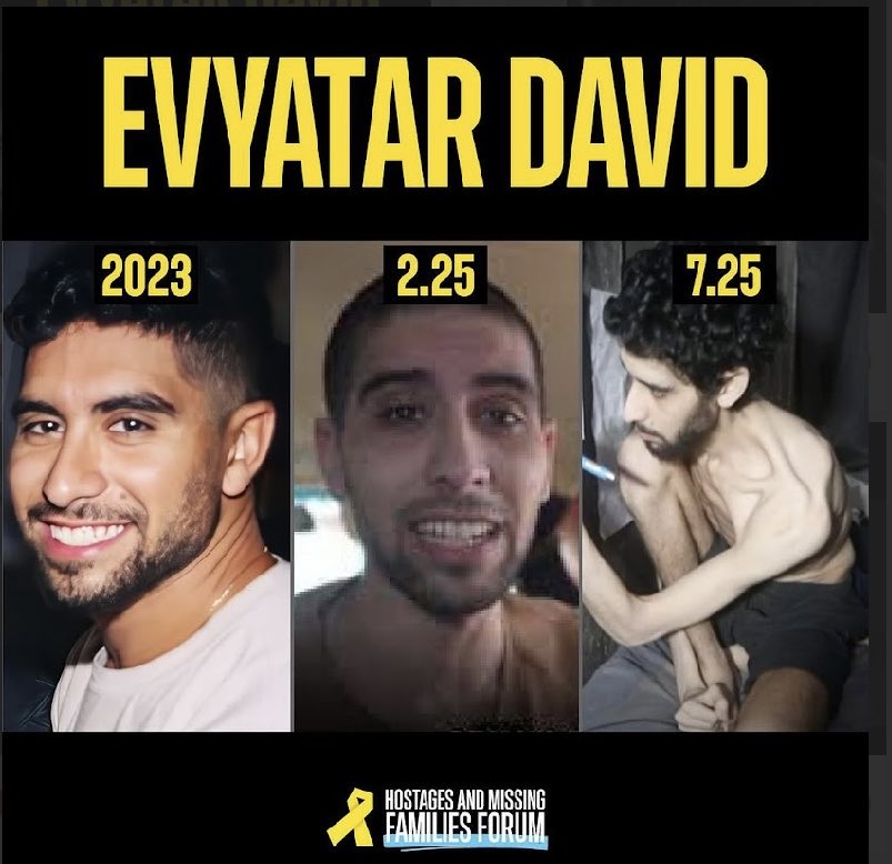 Do not look away!!!! THIS is deliberate starvation and pure evil. 

Evyatar won’t be able to hold on much longer. 

There is not a second to lose! 

⁦<a href="/POTUS/">President Donald J. Trump</a>⁩ ⁦<a href="/netanyahu/">Benjamin Netanyahu - בנימין נתניהו</a>⁩ ⁦<a href="/AGPamBondi/">Attorney General Pamela Bondi</a>⁩ ⁦<a href="/ChadGilmartinCA/">Chad Gilmartin</a>⁩ ⁦<a href="/TheLeoTerrell/">LeoTerrell</a>⁩ ⁦<a href="/SteveWitkoff/">Steve Witkoff</a>⁩