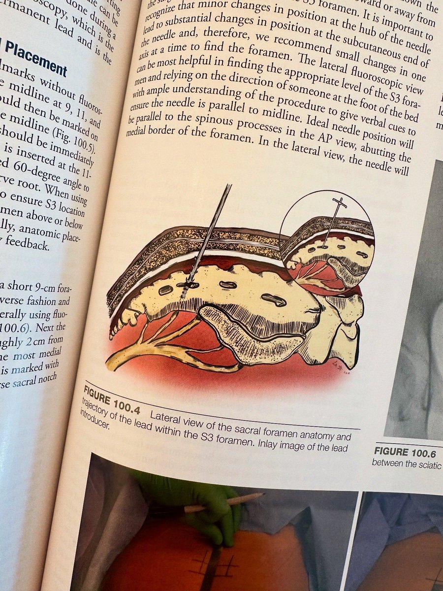 Yeonsoo Sara Lee, MD tweet media