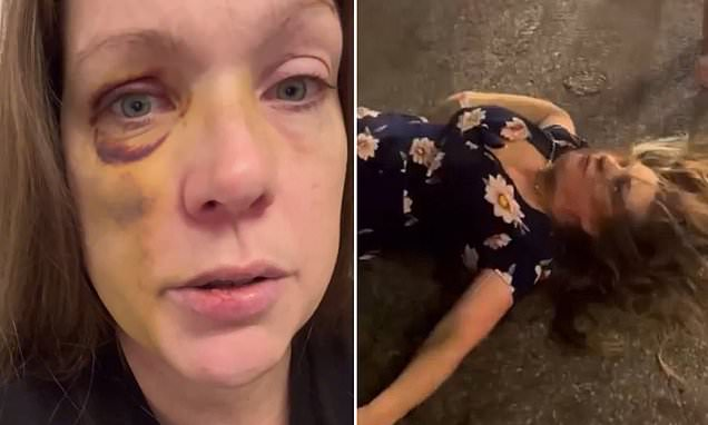 judymorris3's tweet photo. Working mom beaten to a pulp in street fight that shocked America reveals lifechanging injuries she's dealing with #CincinnatiAttack #Racism
In a violent racist attack, she was beaten by black thugs because she was white. It was indeed a racist attack and the perps should be charged with hate crimes.
https://t.co/20z4oe1XV9