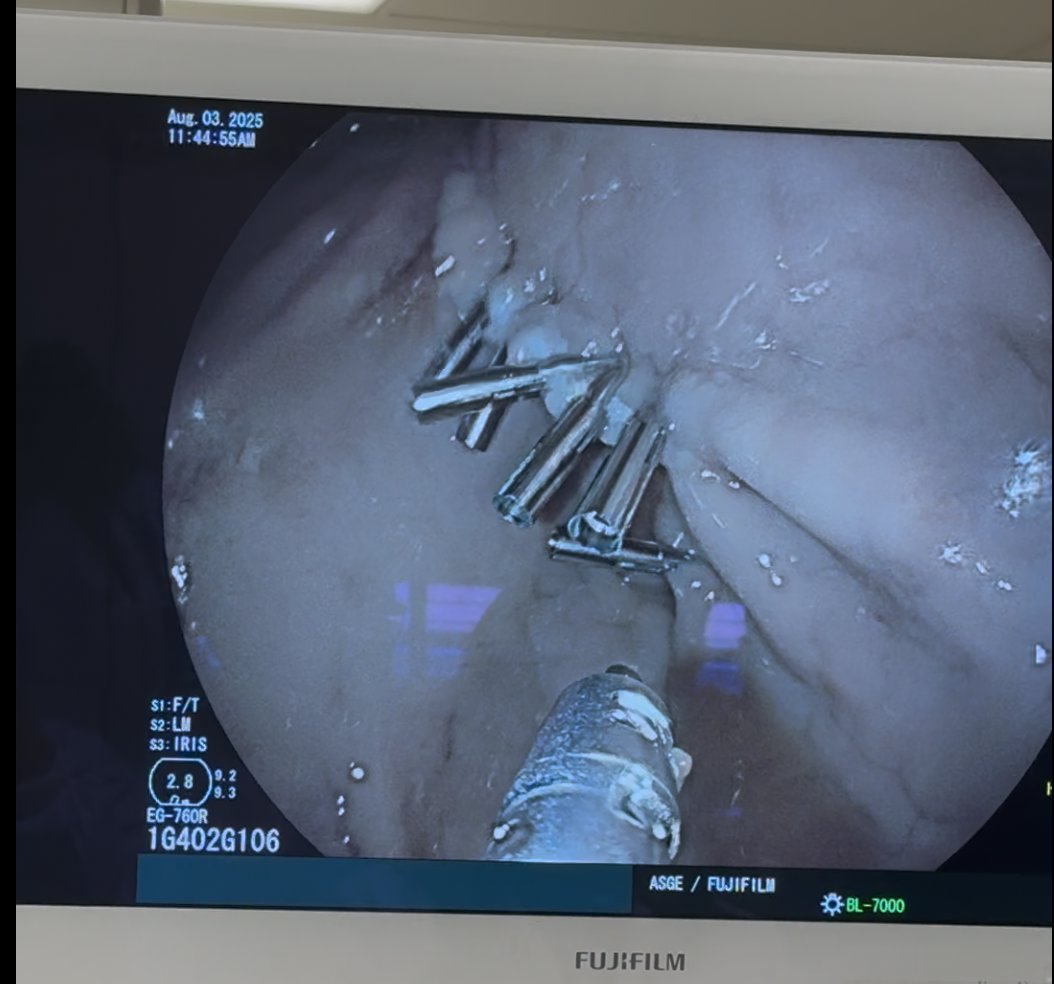 Abraham Z. Cheloff, MD, MS (@abrahamcheloff) on Twitter photo Nothing more fun than spending a weekend at the <a href="/ASGEendoscopy/">ASGE GI Endoscopy</a> First Year Fellows Course - getting to know my co-fellows, closing a complex defect together in the skills lab, and spending time with my all-star mentors <a href="/PopovVioleta/">Violeta Popov, MD PhD</a> and <a href="/AasmaShaukatMD/">Aasma Shaukat MD MPH</a> <a href="/NYULH_GastroHep/">Gastroenterology & Hepatology | NYU Langone Health</a> Nothing more fun than spending a weekend at the <a href="/ASGEendoscopy/">ASGE GI Endoscopy</a> First Year Fellows Course - getting to know my co-fellows, closing a complex defect together in the skills lab, and spending time with my all-star mentors <a href="/PopovVioleta/">Violeta Popov, MD PhD</a> and <a href="/AasmaShaukatMD/">Aasma Shaukat MD MPH</a> <a href="/NYULH_GastroHep/">Gastroenterology & Hepatology | NYU Langone Health</a>