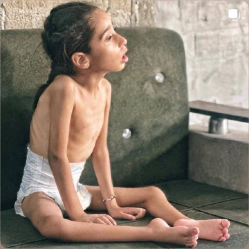 FZ_Ezz's tweet image. 2 million Gazans are starving... It's normal for a despicable person.
 The appearance of pictures of hungry Zionist prisoners The United Nations holds an emergency session that is truly a hypocritical world
#Famine_in_Gaza #stopfamine #GazaGenocide  #FreePalestine #GazaStarving