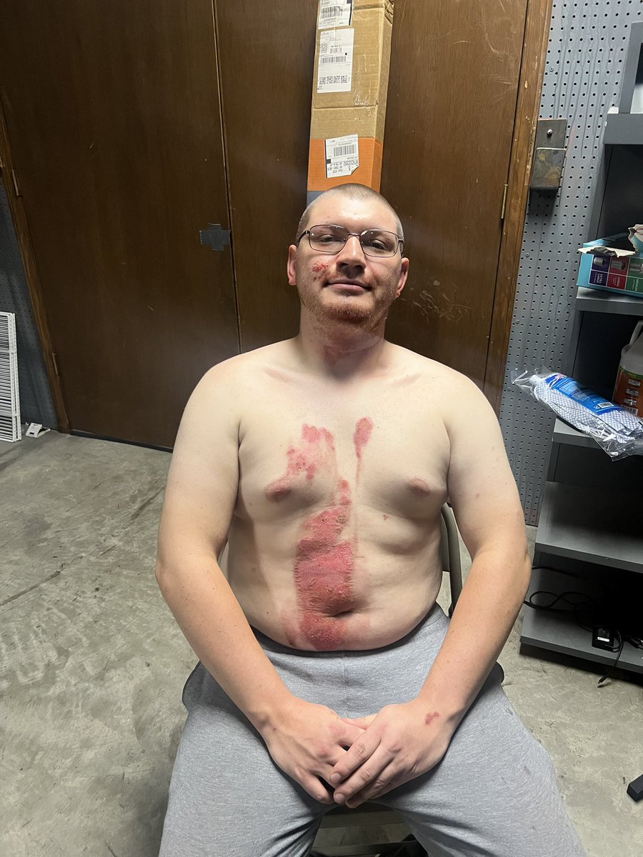 Torture Chamber Live (@torture_live) on Twitter photo The winner of Torture Chamber Live S2 Jacob. Follow him on insta <a href="/p00p_wallet/">Poop_Wallet</a>
#torturechamberlive The winner of Torture Chamber Live S2 Jacob. Follow him on insta <a href="/p00p_wallet/">Poop_Wallet</a>
#torturechamberlive