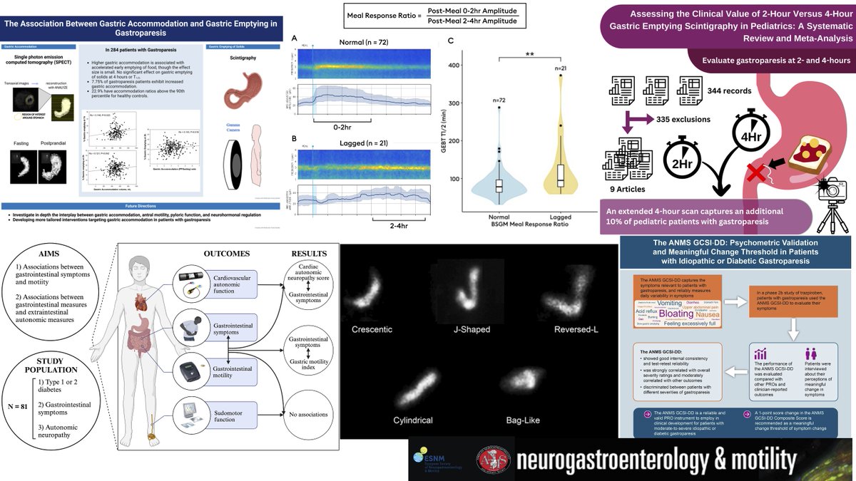 Neurogastro & Motil (@ngmjournal) on Twitter photo 🚨#GastroparesisAwarenessMonth2025🔥
Recent Highlights on #Gastroparesis articles‼️
#DiveDeep⏬
<a href="/maura_corsetti/">maura corsetti</a> <a href="/IBS_Maastricht/">Daniel Keszthelyi MD PhD RFF</a> FrankZerbib KirsteenBrowning <a href="/DrCJBlack/">Chris Black</a> <a href="/AndreaShin_GI/">Andrea Shin</a> <a href="/mpj61/">Michael Jones</a> <a href="/nicolascenac/">nicolasc</a> <a href="/ThisIsButt/">Mohsin Butt</a> <a href="/Pierfra_Visaggi/">Pierfrancesco Visaggi, MD</a> KristinElfers WilmarieMorales <a href="/Rajan___Singh/">Rajan Singh</a>👏 🚨#GastroparesisAwarenessMonth2025🔥
Recent Highlights on #Gastroparesis articles‼️
#DiveDeep⏬
<a href="/maura_corsetti/">maura corsetti</a> <a href="/IBS_Maastricht/">Daniel Keszthelyi MD PhD RFF</a> FrankZerbib KirsteenBrowning <a href="/DrCJBlack/">Chris Black</a> <a href="/AndreaShin_GI/">Andrea Shin</a> <a href="/mpj61/">Michael Jones</a> <a href="/nicolascenac/">nicolasc</a> <a href="/ThisIsButt/">Mohsin Butt</a> <a href="/Pierfra_Visaggi/">Pierfrancesco Visaggi, MD</a> KristinElfers WilmarieMorales <a href="/Rajan___Singh/">Rajan Singh</a>👏