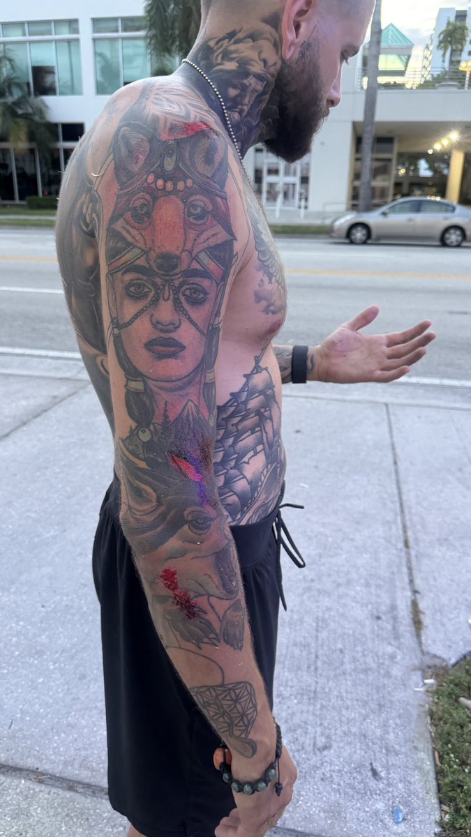 EliOnKick's tweet photo. Got hit by a car. All good. https://t.co/tacNDTLgO7