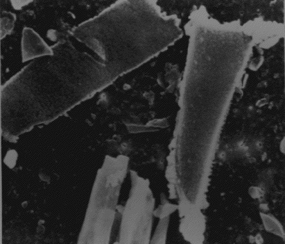 "Wood  smoke particle taken from a human lung enlarged. (Original picture size  3 7/8 " by 3 3/8" at 900x enlargement. "Chest p.1232. Interstitial Lung  Disease and Domestic Wood Burning, Ramage, Roggli, Bell and  Piantadosi.") There is no safe level of "smoke" These poison... "