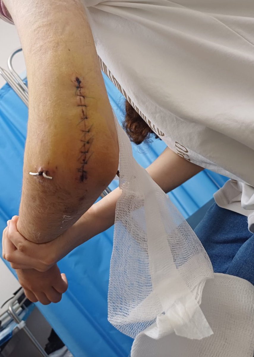 Maha AKram (@maay596813) on Twitter photo My daughter Lina is collapsing in pain, and I'm helpless. 😭💔
We desperately need $200 to buy medicine.
Consider her your sister, or your daughter...
With every passing minute, her pain increases.
Please don't let her suffer Help us.
gofund.me/96b96fbc
<a href="/Louis_Allday/">Louis Allday</a> My daughter Lina is collapsing in pain, and I'm helpless. 😭💔
We desperately need $200 to buy medicine.
Consider her your sister, or your daughter...
With every passing minute, her pain increases.
Please don't let her suffer Help us.
gofund.me/96b96fbc
<a href="/Louis_Allday/">Louis Allday</a>