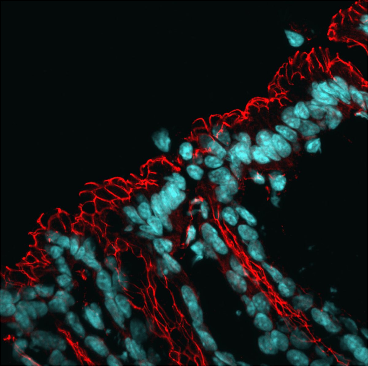 CSIC (@csic) on Twitter photo 🔬Un estudio del <a href="/CBM_CSIC_UAM/">Centro de Biología Molecular Severo Ochoa</a> demuestra que el deterioro asociado a la edad de los linfocitos T CD4 debilita la barrera intestinal y favorece la inflamación crónica y el envejecimiento celular
💉 El trabajo también presenta una posible terapia
➡️ tinyurl.com/97ssrv74 🔬Un estudio del <a href="/CBM_CSIC_UAM/">Centro de Biología Molecular Severo Ochoa</a> demuestra que el deterioro asociado a la edad de los linfocitos T CD4 debilita la barrera intestinal y favorece la inflamación crónica y el envejecimiento celular
💉 El trabajo también presenta una posible terapia
➡️ tinyurl.com/97ssrv74