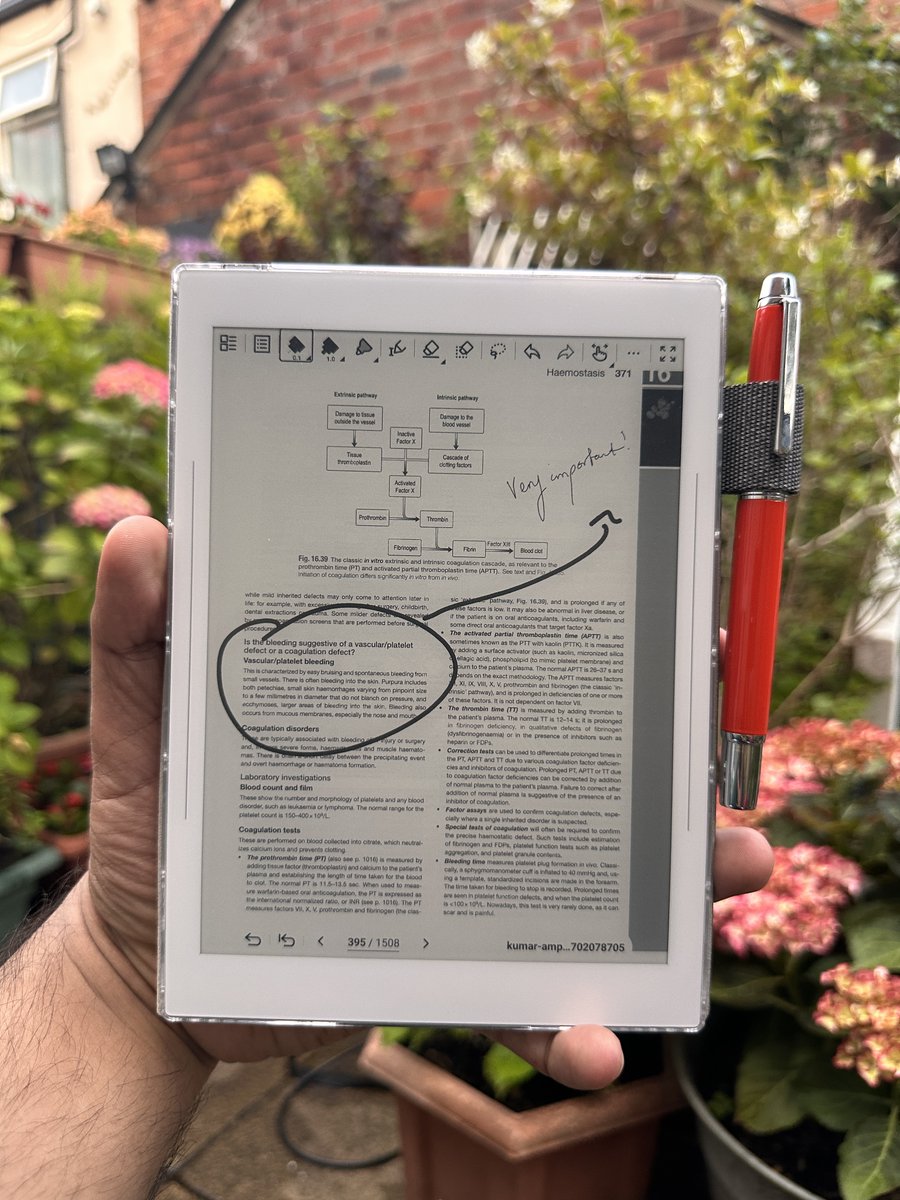 Supernote (@rattasupernote) on Twitter photo How does a medical student survive chaos? Our latest case study features a student who uses Supernote to streamline his workflow, from patient histories to textbook annotations.
Read the full story on the Supernote blog: supernote.com/blogs/supernot… How does a medical student survive chaos? Our latest case study features a student who uses Supernote to streamline his workflow, from patient histories to textbook annotations.
Read the full story on the Supernote blog: supernote.com/blogs/supernot…