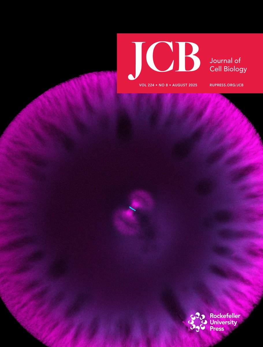 Rockefeller U. Press (@rockupress) on Twitter photo .<a href="/JCellBiol/">Journal of Cell Biology</a>'s August issue is here! hubs.la/Q03zqtYG0
The cover shows confocal #microscopy image of a #Xenopus laevis zygote in metaphase of the first embryonic #mitosis stained by immunofluorescence to visualize spindle. From Cantwell et al. hubs.la/Q03zqrGc0 .<a href="/JCellBiol/">Journal of Cell Biology</a>'s August issue is here! hubs.la/Q03zqtYG0
The cover shows confocal #microscopy image of a #Xenopus laevis zygote in metaphase of the first embryonic #mitosis stained by immunofluorescence to visualize spindle. From Cantwell et al. hubs.la/Q03zqrGc0