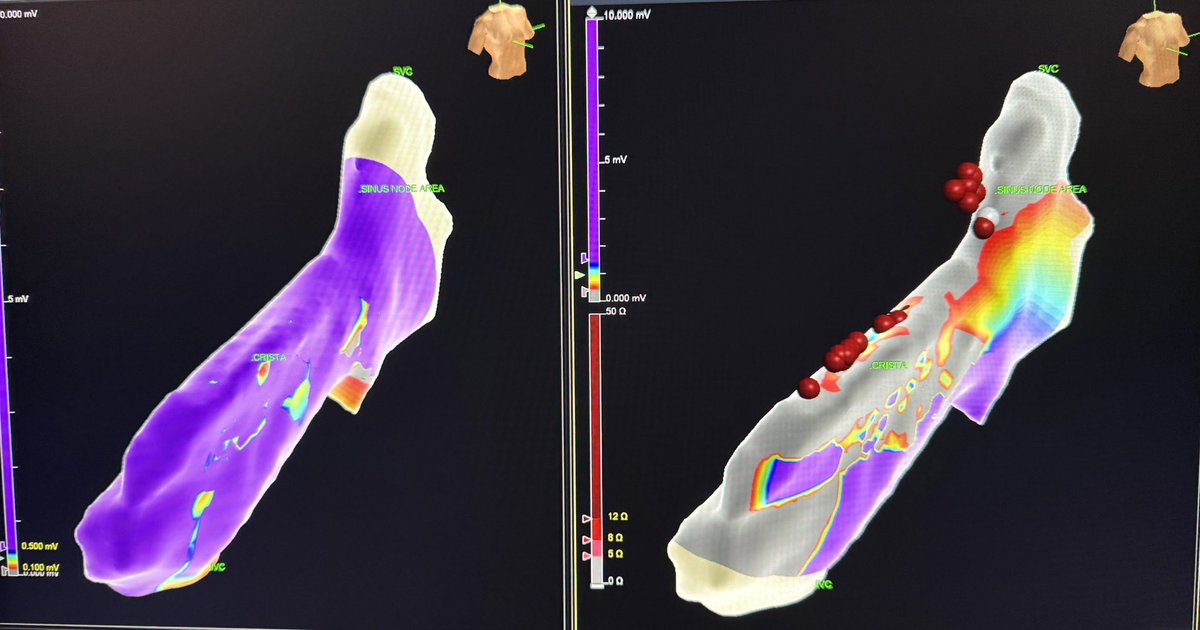 Zain Khalpey, MD, PhD, FACS tweet media