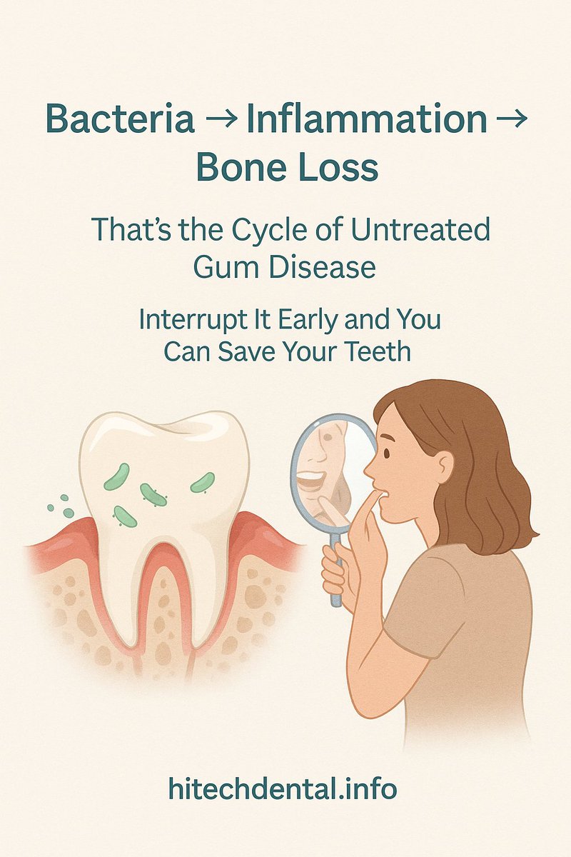HTdental_info's tweet image. Bacteria → Inflammation → Bone Loss.
That’s the silent cycle of gum disease — and it can cost you your smile.
The earlier you interrupt it, the better your chances of saving your teeth.
👉 hitechdental.info/periodontal-tr…
#GumHealth #ToothLossPrevention #PeriodontalCare #HiTechDental