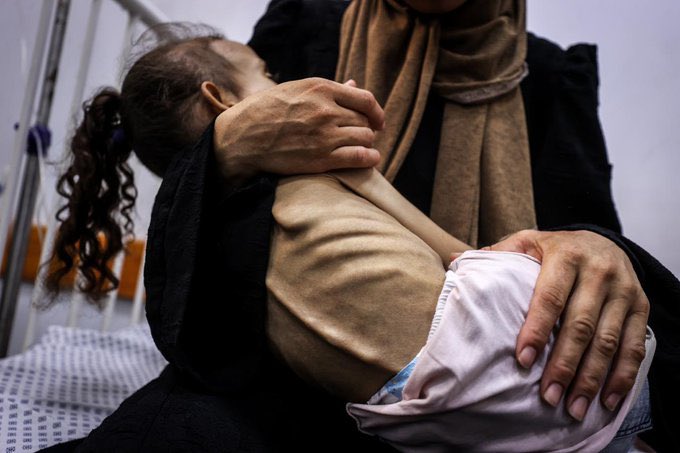 svknesibe (@svknesibe1) on Twitter photo Gazze "açlıktan" ölüyor...
İşgalci İsrail'in ablukası nedeniyle Gazze'de son 24 saatte 5 Filistinli daha açlıktan hayatını kaybetti.
Gazze'de açlıktan ölenlerin sayısı 93'ü çocuk olmak üzere 180'e yükseldi. Gazze "açlıktan" ölüyor...
İşgalci İsrail'in ablukası nedeniyle Gazze'de son 24 saatte 5 Filistinli daha açlıktan hayatını kaybetti.
Gazze'de açlıktan ölenlerin sayısı 93'ü çocuk olmak üzere 180'e yükseldi.