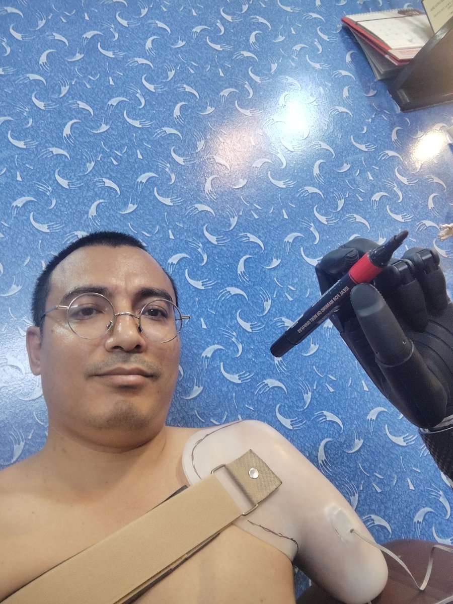 VR_Tandukar's tweet image. I&apos;ll have a beautiful handwriting
#AmputeeLife #Tech4Life #DisabilityAccess