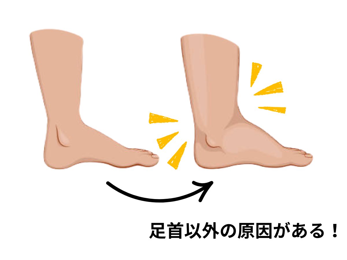 "足首がパンパンにむくんでいる"

背中全体が硬くなっていて、足首が使われずらくなっている可能性があります。

足関節の可動域はあるのに、歩行や日常生活では本来の動きが出ていない状態。

エクササイズに続きます↓↓