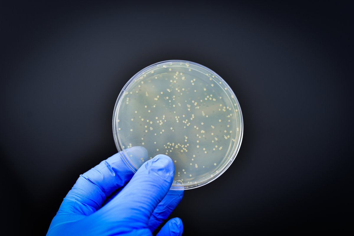 🦠Investigadores del CSIC realizan una amplia secuenciación de los genes de resistencia bacterianos presentes en la cadena alimentaria.
Estos hallazgos son clave para diseñar estrategias de prevención de resistencias a antibióticos.
➡️ csic.es/es/actualidad-…