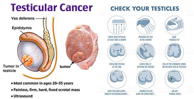 aproko_doctor's tweet image. Get your hands soapy and do this:

Please check your testicles

Do it in the bathroom; rub soap on your hands so it’s easy to run your hands and examine your balls

Look out for lumps, size, pain, etc.

Testicular cancer is real, and it kills. Just check today. RT for other men