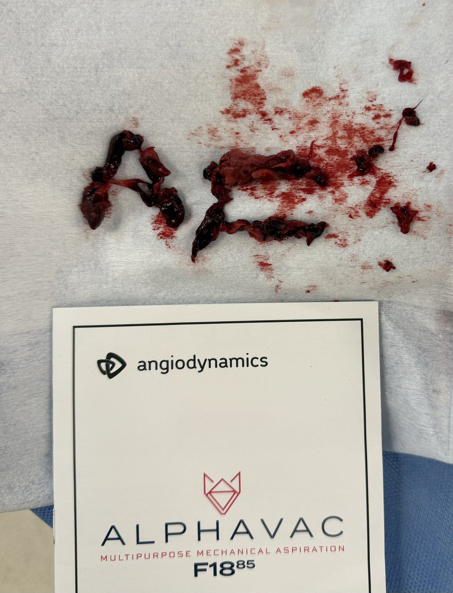 AFawzyElsayed's tweet image. #ALPHAVAC #ANGIODYNAMICS #ATH #PE #AF
@angiodynamics