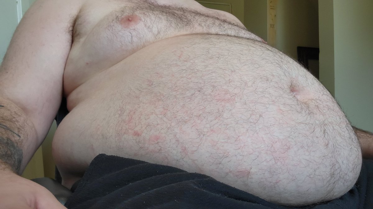 Stretch marks are making a return 😈