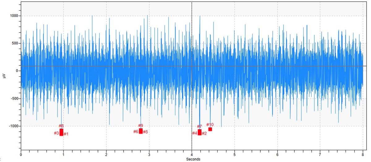 V-belt misalignment can lead to silent failures and costly downtime. In this case study, ultrasound detected tension loss and angular #Misalignment in a motor-blower assembly—well before failure occurred.
Read how early detection can extend asset life:
linkedin.com/pulse/identify…