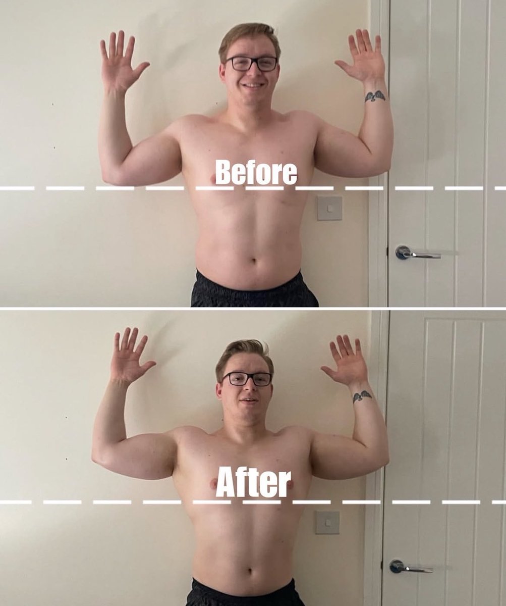 RebeccaTalbot01's tweet image. 💪 Shoulder mobility unlocked!
Worked on Ryan’s lateral rotators and abductors today  arms lifted higher &amp;amp; pain-free by the end of just one session!🙌
Noticing arm drop during presses or dealing with a shoulder niggle? Let’s fix it fast. DM to book📨

#ShoulderMobility #FixItFast