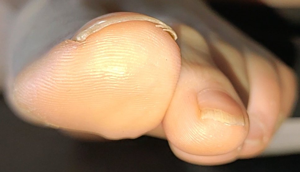 patreon.com/posts/videofra…