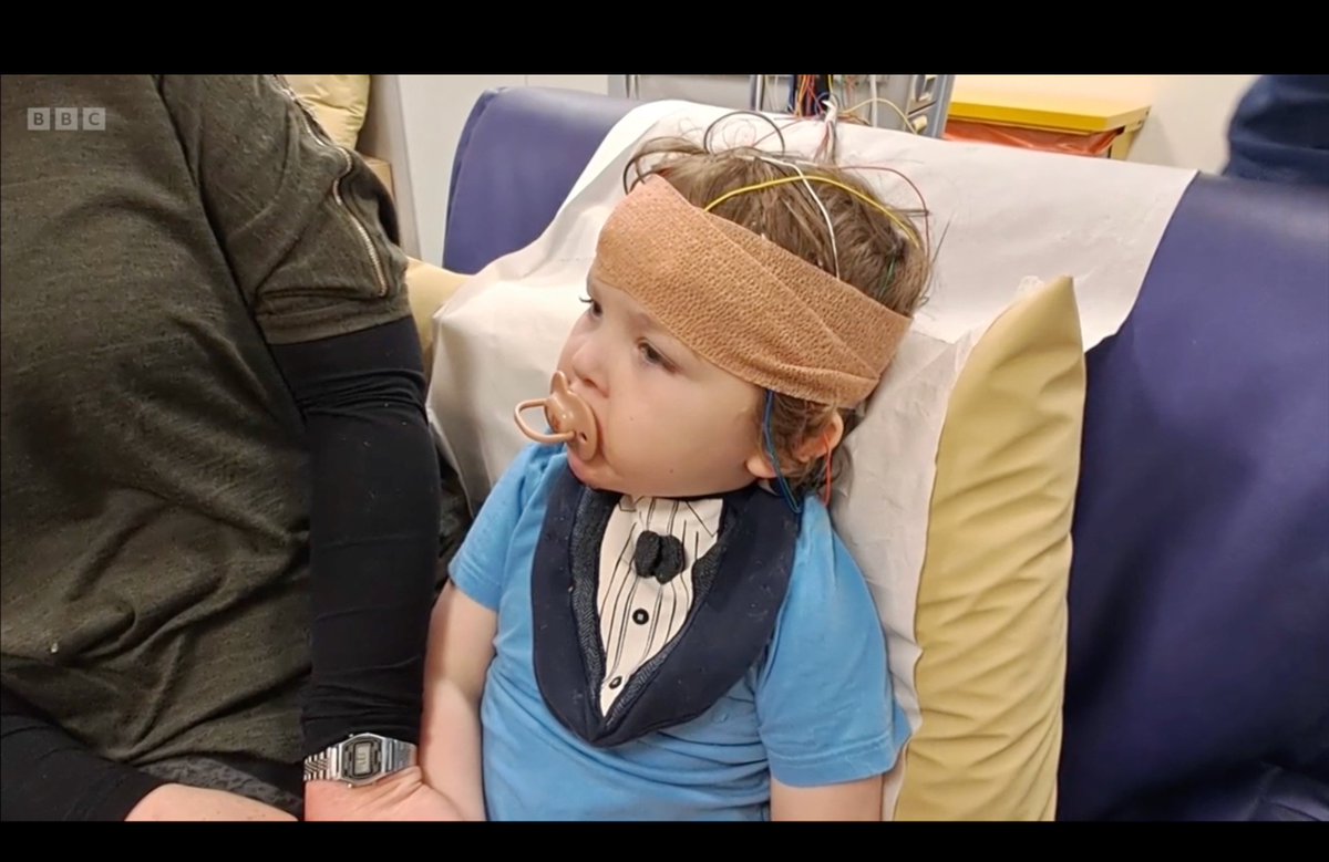 If you think you face challenges, spare a thought for 5 yo Bobby who has #BCL11B and his family. Only 58 recorded cases globally of this incredibly rare genetic disorder. 
My report on <a href="/BBCiPlayer/">BBC iPlayer</a> (<a href="/BBCLookEast/">BBC East</a>) now...