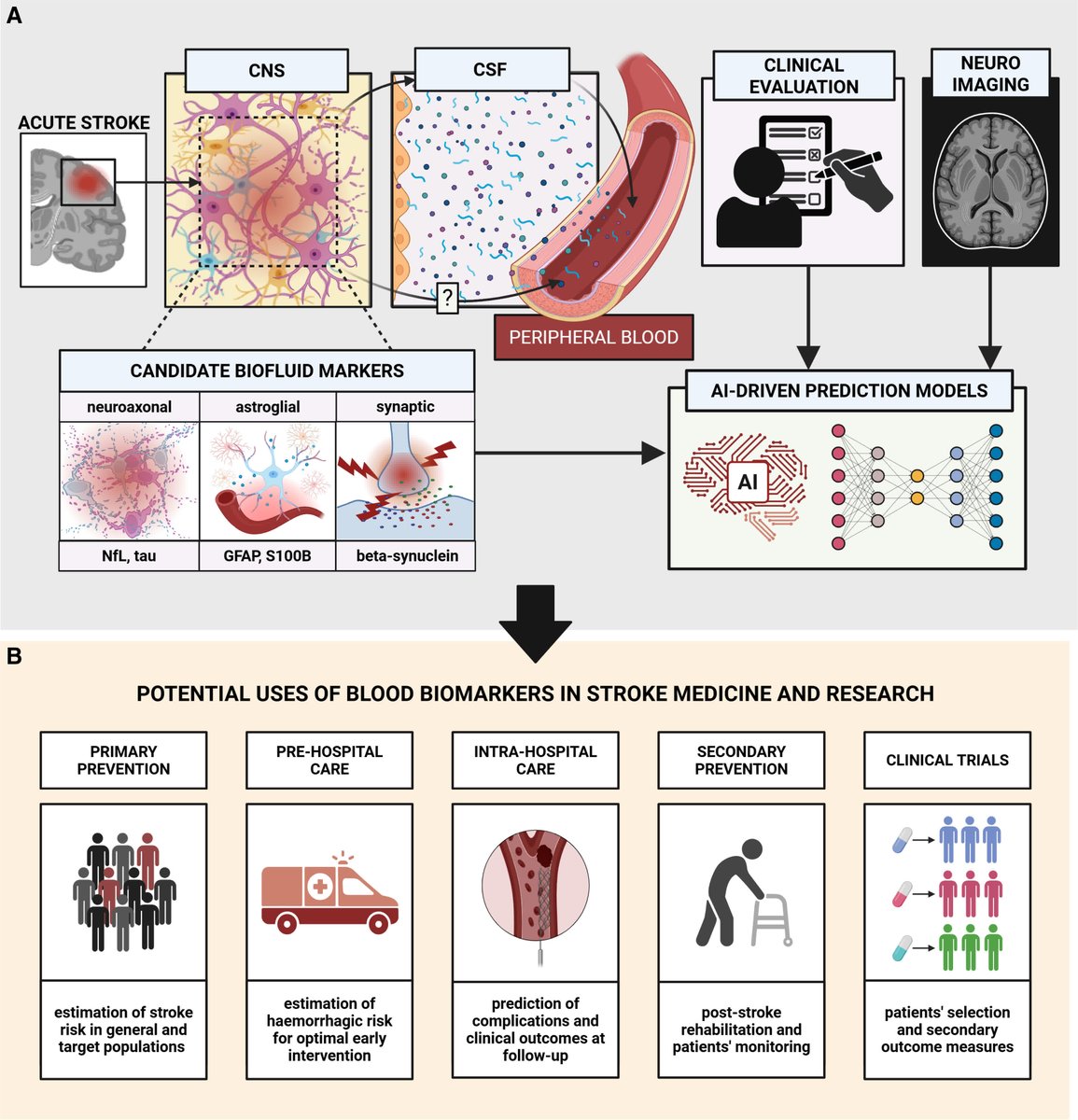 Stroke AHA/ASA (@strokeaha_asa) on Twitter photo #STROKE: This Comments and Opinions piece by <a href="/lorbarba/">Lorenzo Barba</a> et al. outlines the promises and pitfalls in the use of blood-based biomarkers in ongoing stroke clinical trials. <a href="/famontellano/">Felipe A. Montellano</a> <a href="/luciodanna2/">luciodanna</a> #AHAJournals ahajrnls.org/451wodl #STROKE: This Comments and Opinions piece by <a href="/lorbarba/">Lorenzo Barba</a> et al. outlines the promises and pitfalls in the use of blood-based biomarkers in ongoing stroke clinical trials. <a href="/famontellano/">Felipe A. Montellano</a> <a href="/luciodanna2/">luciodanna</a> #AHAJournals ahajrnls.org/451wodl