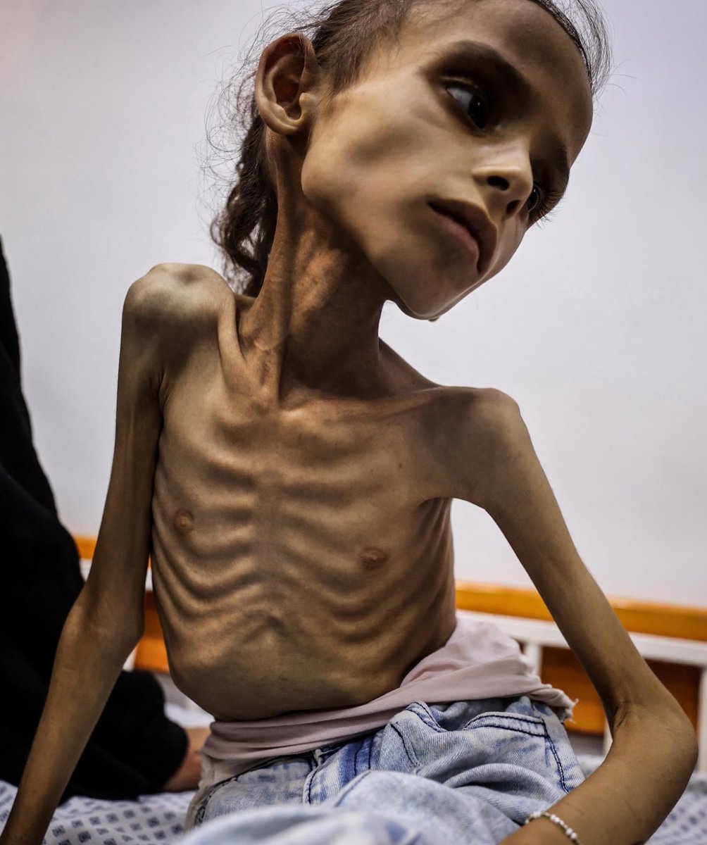 Se llama Maryam Duvvas y tiene 9 años. Israel es un Estado genocida. Malditos sean estos sádicos que están masacrando al pueblo palestino y las alimañas que los apoyan.