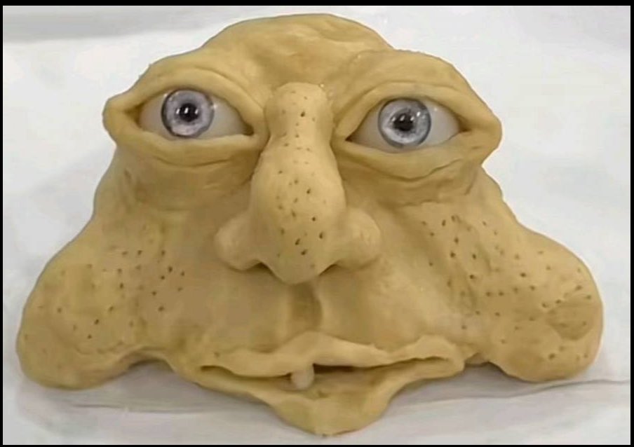 Chronicconstipation tweet media