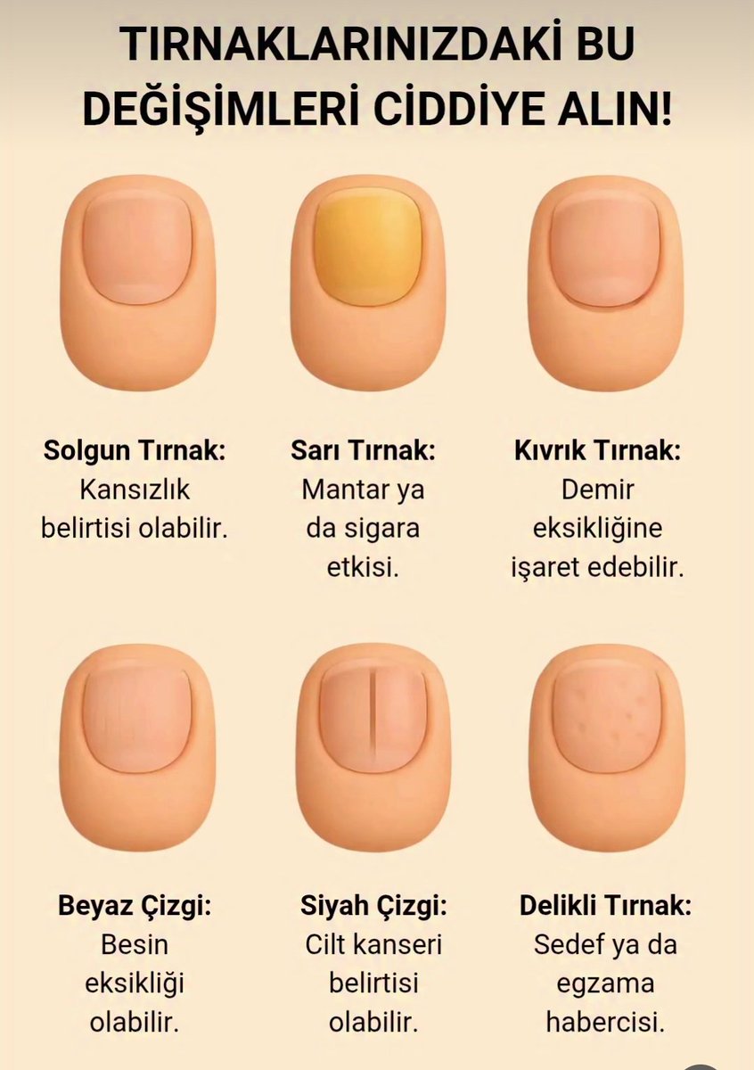 Tırnaklarınızdaki bu değişimleri ciddiye alın