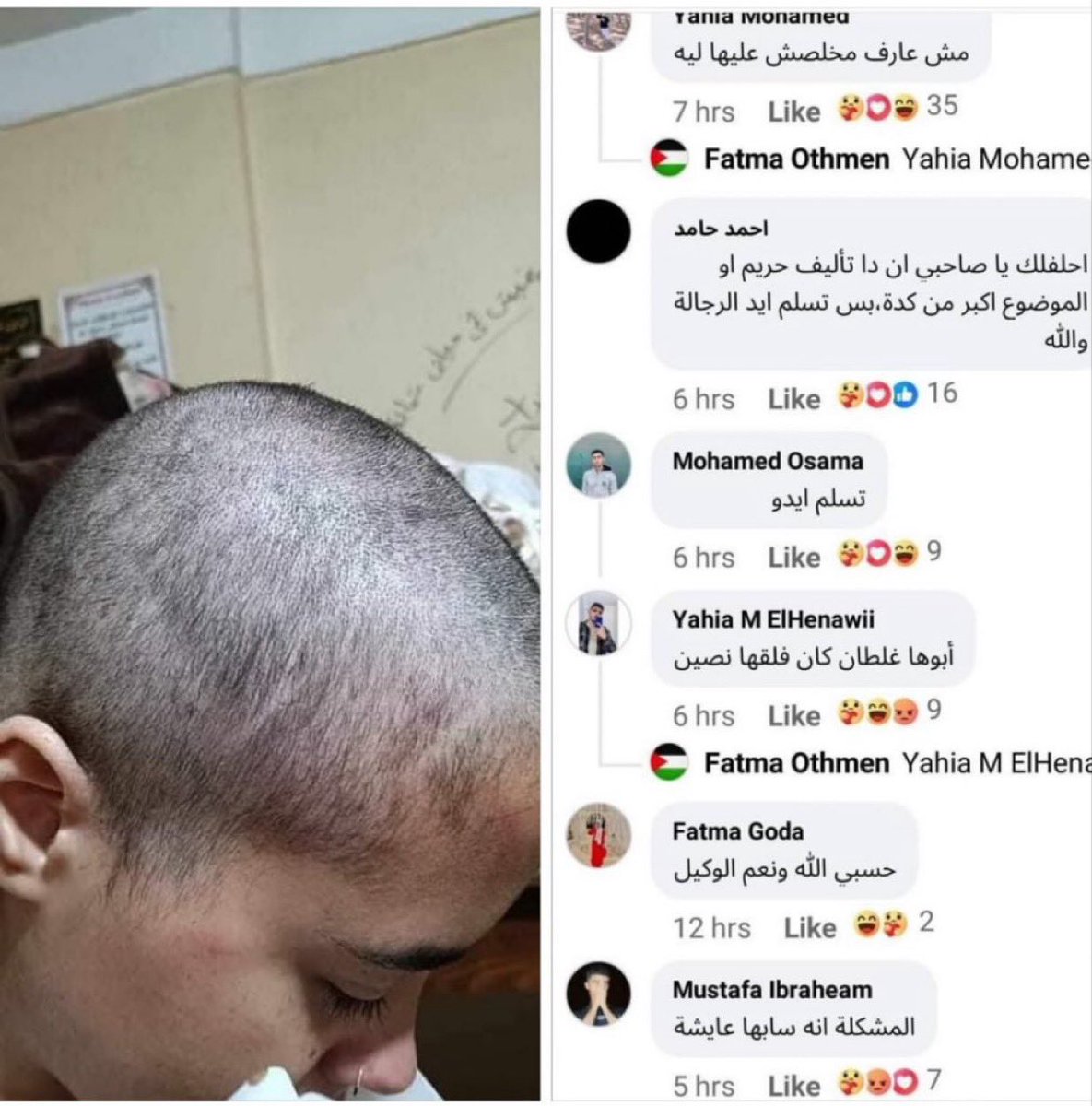 An Egyptian girl was beaten and had her head shaved by her family for refusing to wear the hijab. They posted her photo online to further humiliate her.

The comments on the post are encouraging the family to ‘finish the job’ and kill her.