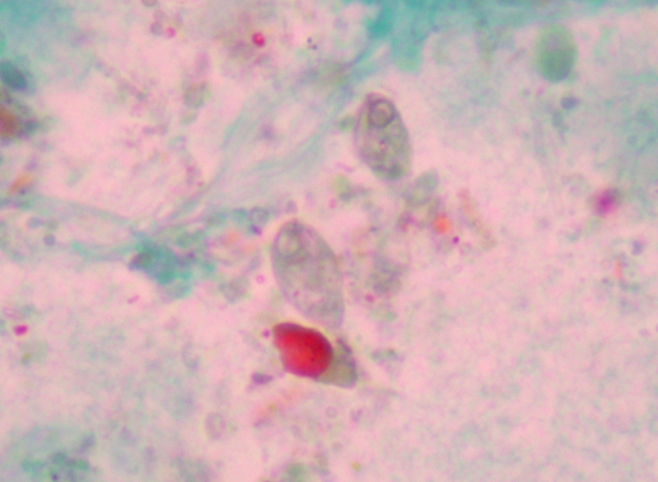 Bobbi Pritt, MD tweet media