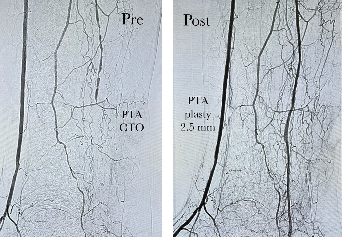 Karan Anandpara tweet media