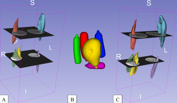 Oliver Faude (@oliverfaude) on Twitter photo Our new paper on 3D ultrasound to estimate muscle volume.
"Despite limitations, it is a promising, cost-effective method for tracking longitudinal muscle changes."
Thanks to <a href="/ritpau/">Paul Ritsche</a> <a href="/RomLed_/">Romina Ledergerber</a> <a href="/MriFranz/">Francesco Santini - ESMRMB2025 Program Chair</a> 🙏
link.springer.com/article/10.100… Our new paper on 3D ultrasound to estimate muscle volume.
"Despite limitations, it is a promising, cost-effective method for tracking longitudinal muscle changes."
Thanks to <a href="/ritpau/">Paul Ritsche</a> <a href="/RomLed_/">Romina Ledergerber</a> <a href="/MriFranz/">Francesco Santini - ESMRMB2025 Program Chair</a> 🙏
link.springer.com/article/10.100…