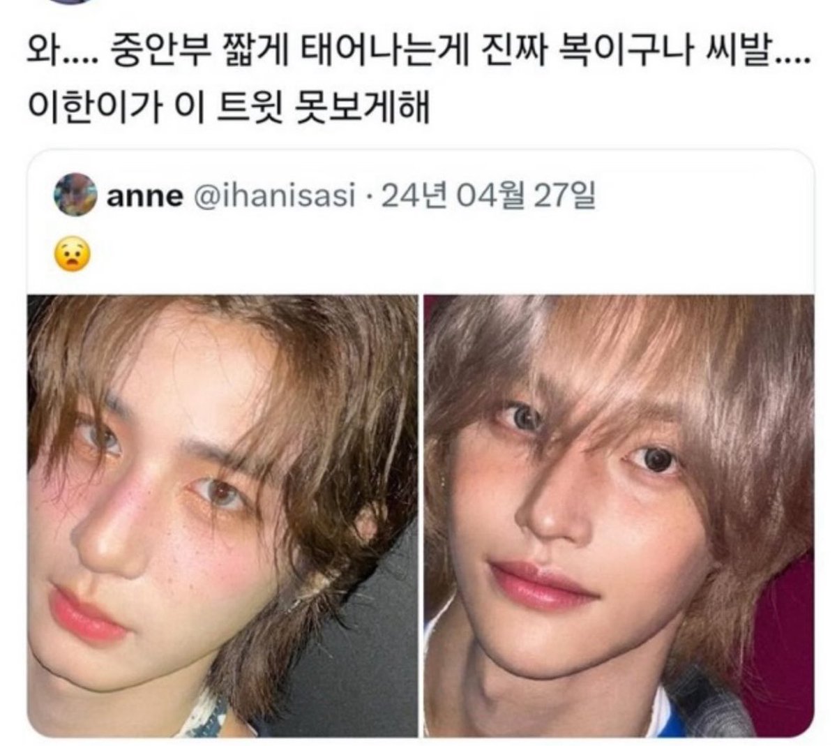 #일본지진에는기부하고_국내산불은무시하는_트레저