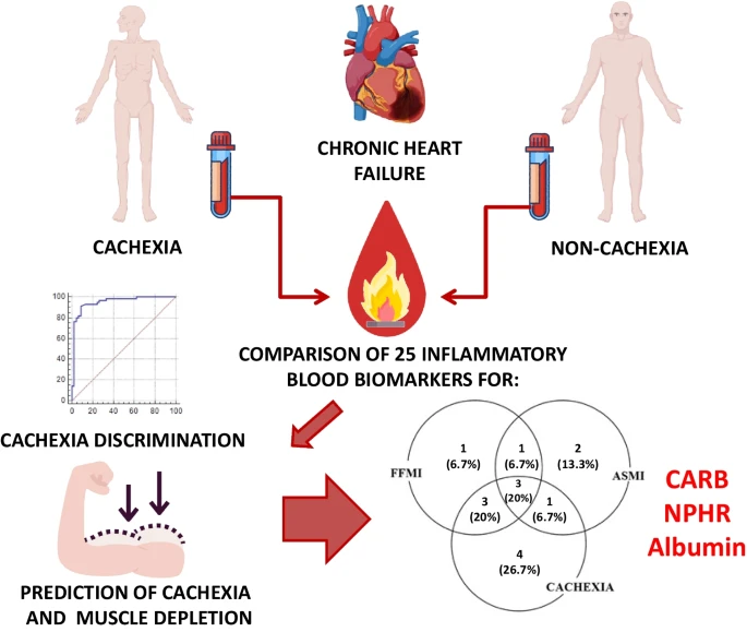 Identification of Candidate Inflammatory-Nutritional Blood Biomarkers for Cachexia and Muscle Depletion in Polish Chronic Heart Failure Patients

link.springer.com/article/10.100…
