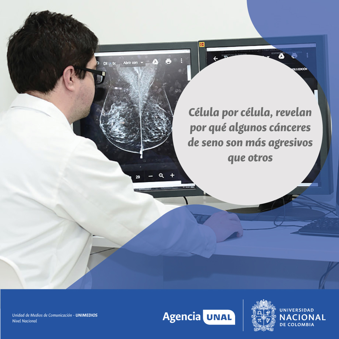 #AgenciaUNAL | Un estudio en genética humana reveló que, incluso dentro de los subtipos más agresivos de cáncer de seno, los tumores muestran gran variabilidad genética: algunos con más alteraciones cromosómicas y otros más estables.

ow.ly/7kOw50WA00P